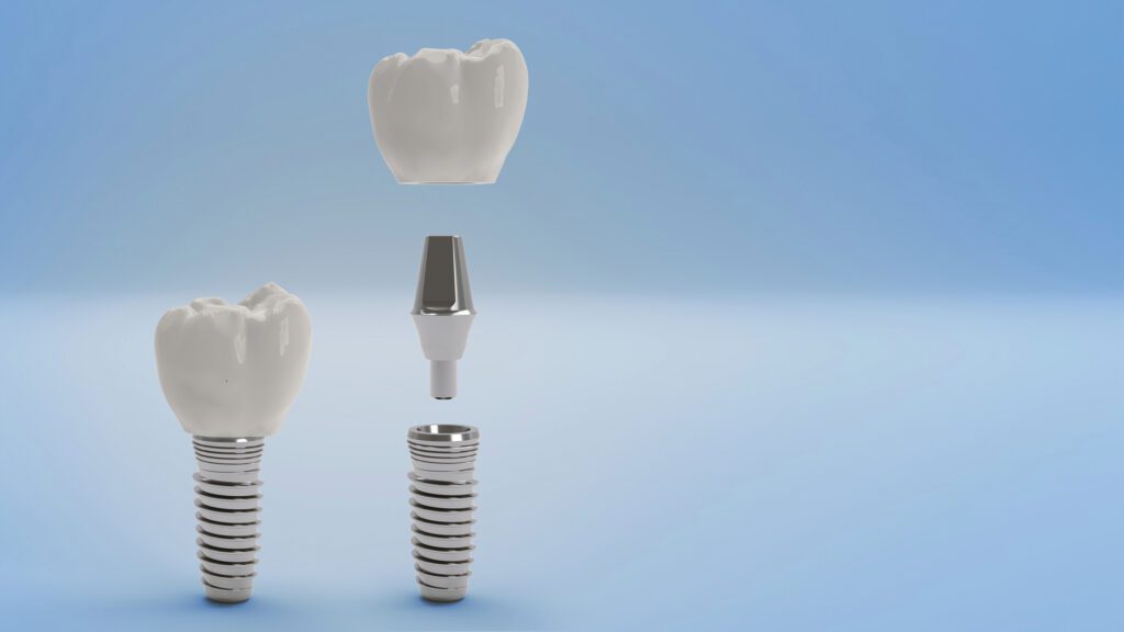Parts of Dental Implant Hillsborough NC